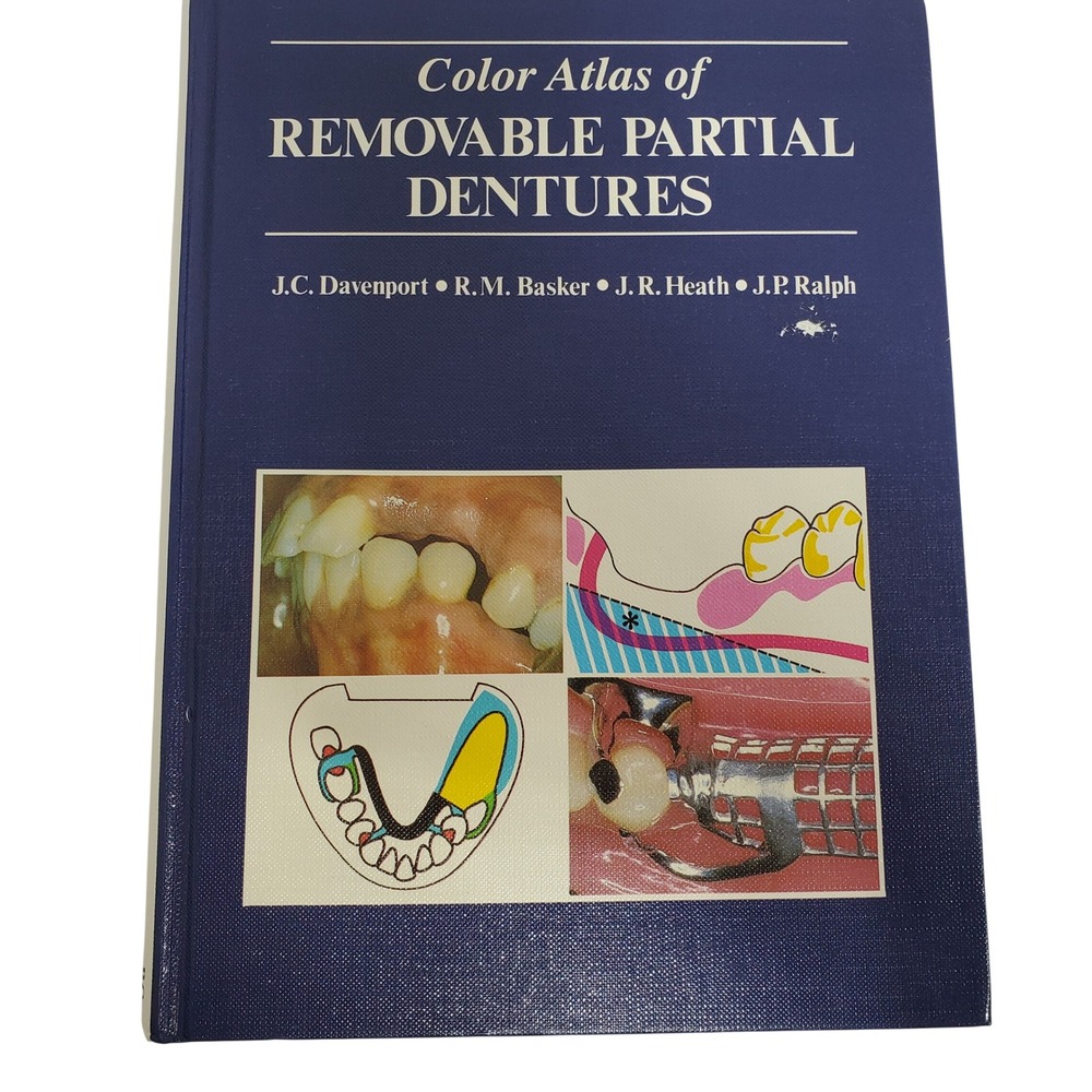 Color Atlas of Removable Partial Dentures Davenport Basker Heath Ralph